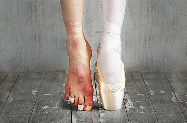 ballet3 ballet3