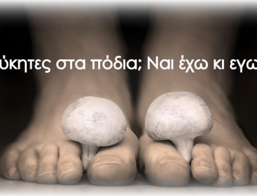 Μυκητιάσεις ονύχων. Ναι έχω κι εγώ!!!